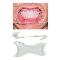 Ortho - Double Ended Photo Cheek Retractors